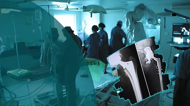 4-Joint-Replacement-Surgery