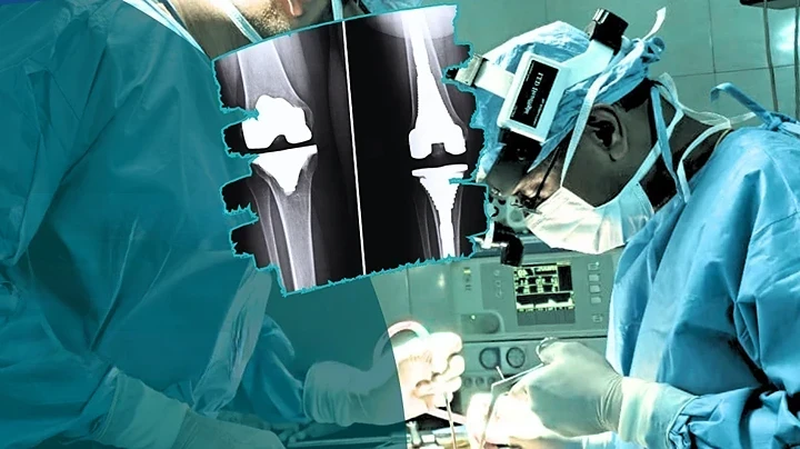 5-Joint-Replacement-Surgery