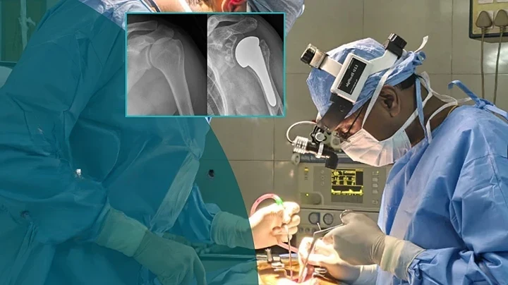 8-Joint-Replacement-Surgery