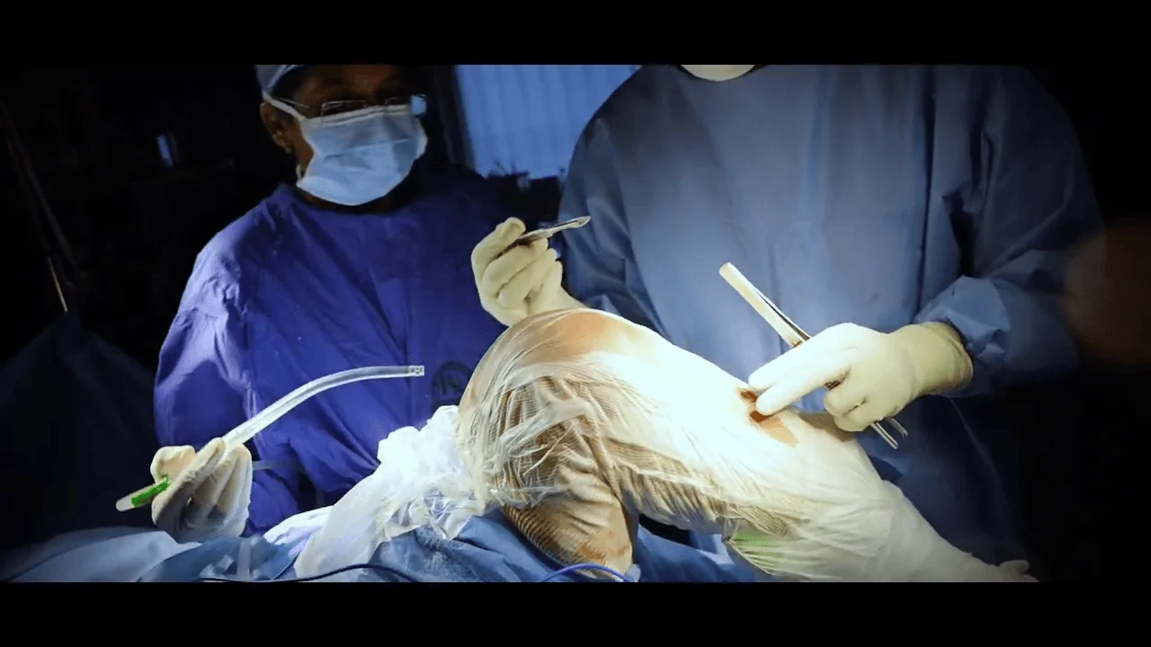 Potential Benefits of Fully Automatic Robotic Total Knee Replacement